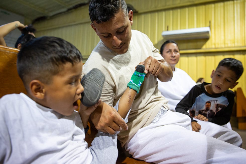 Omar Tortua, 27, from Venezuela, lifts shows the slash wound his 5-year-old son Jesús suffered from razor wire crossing the Rio Grande.